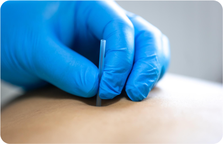 Laproscopic Surgery